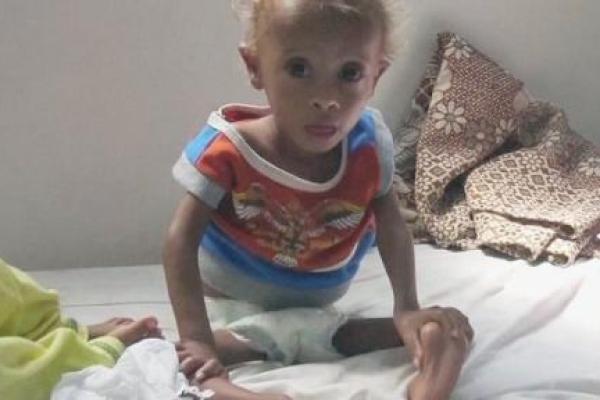 Hajjar Yaman kembali Diserang Wabah Kolera