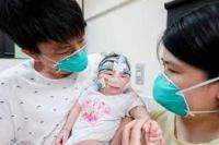 Bayi Terkecil di Dunia Akhirnya Boleh Pulang Setelah Dirawat Setahun Lebih 