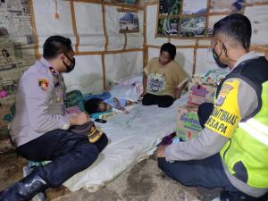  Bantuan Mulai Mengalir untuk Balita Penderita Hidrosefalus di Kupang