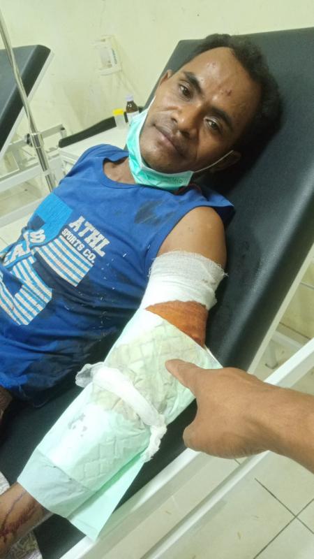  Nyaris Habisi Tetangga, Eks Narapidana di Kupang Malah Tewas Dimassa 