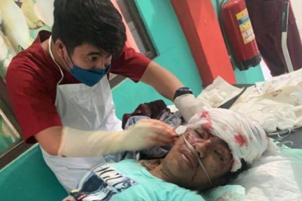 Lakalantas di TTS, Dump Truk Senggol Bus Akibatkan Penumpang Luka Parah