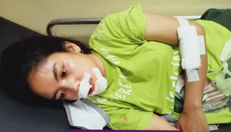 Kisah Ibu di Kupang Berupaya Tangkap Pencuri tapi Malah Babak Belur
