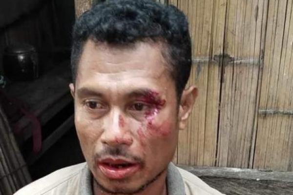 Yanses Tapatab (41), warga RT 006/RW 003, Dusun II, Desa Oelfatu, Kecamatan Amfoang Barat Laut, Kabupaten Kupang, babak belur dianiaya tetangganya sendiri akhir pekan lalu.
