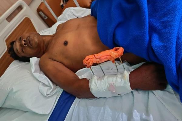 Selama Enam Tahun Terakhir Sembilan Warga Dimangsa Buaya di SM Tuadale-Kupang Barat