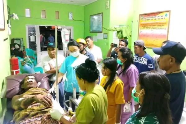 Dua Warga Flores Timur Alami Luka Bakar Terkena Letusan Gunung Lewotobi di Flores Timur