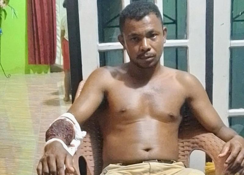 Aloisius Atok alias Alo penderita difabel mengalami patah tangan usai dikeroyok sekelompok pemuda di Sesekoe, Kabupaten Belu perbatasan RI-RDTL. 